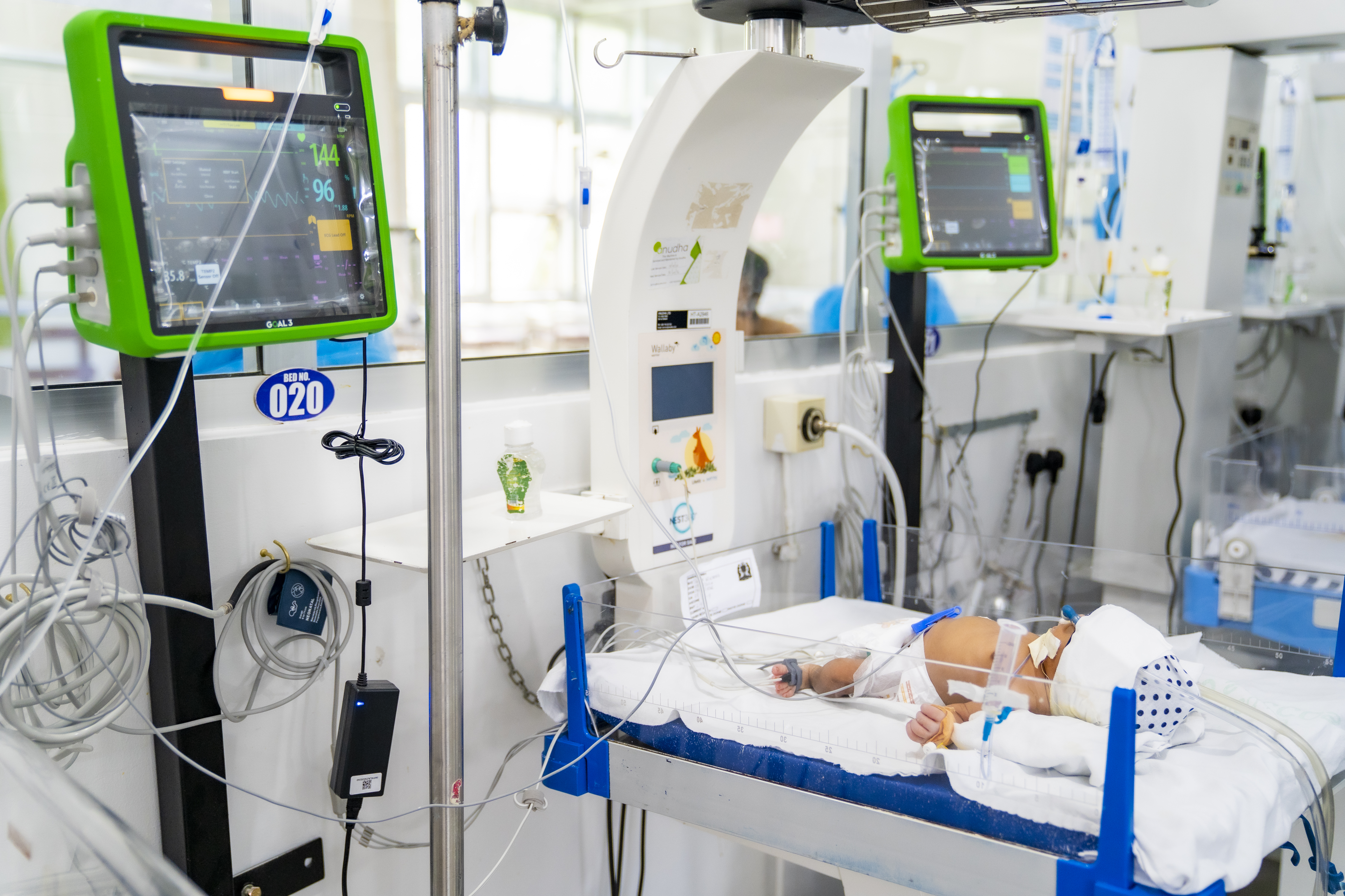 IMPALA monitor in use on a hospital ward